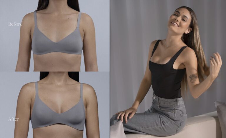 Mia Fem Tech injectable breast implants before and after