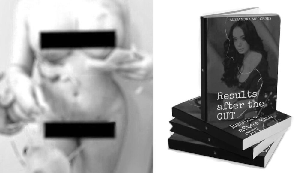 alejandra-mercedes-new-plastic-surgery-book