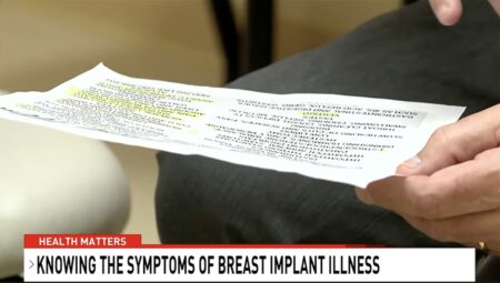 Ill From Implants, CBS News Anchor Explants – Surgical Times