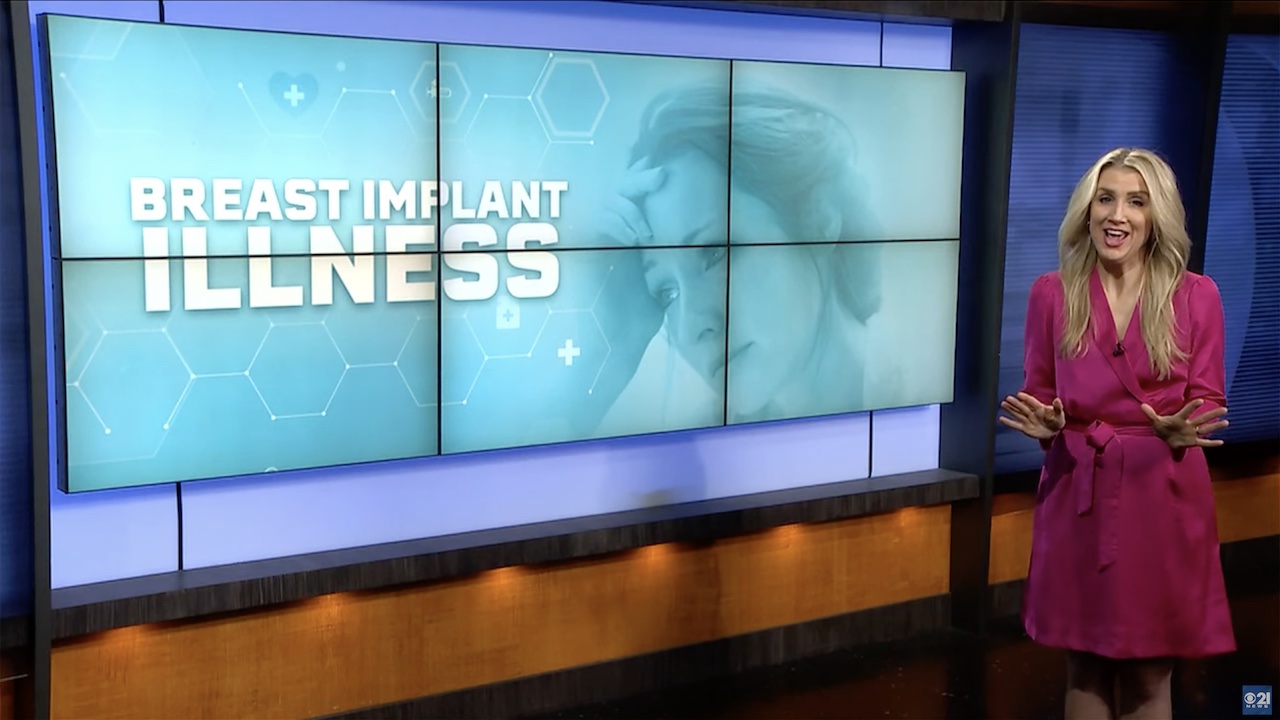 Ill From Implants, CBS News Anchor Explants - Surgical Times